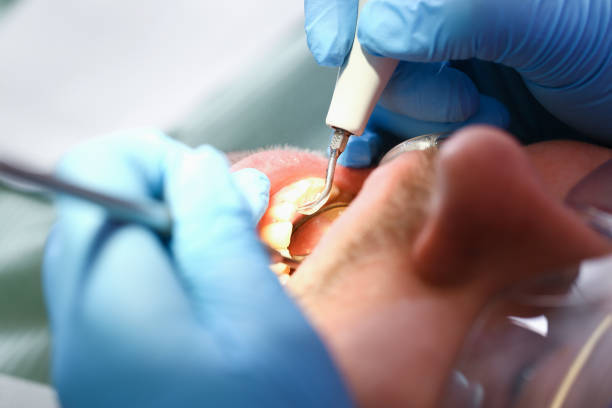 Best Orthodontic Emergency Dentist in Lake Mary Jane, FL