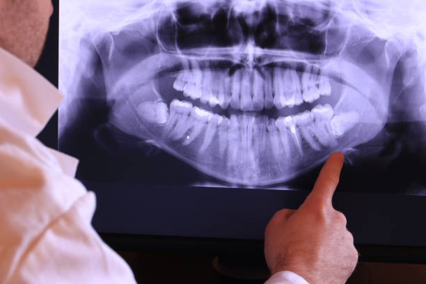 Best Emergency Dental Care for Abscessed Tooth in Lake Mary Jane, FL